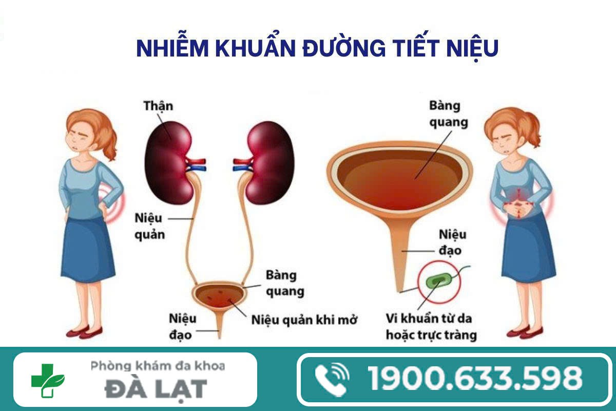 Hình ảnh minh họa